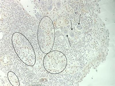 Control Strategies for Carcinogenic-Associated Helminthiases: An Integrated Overview